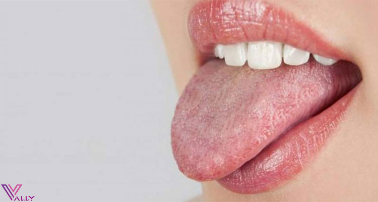 دلیل تلخی دهان در طب سنتی