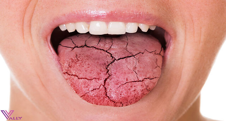 دلیل تلخی دهان بعد از خوردن غذا