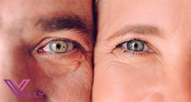 درمان پیر چشمی