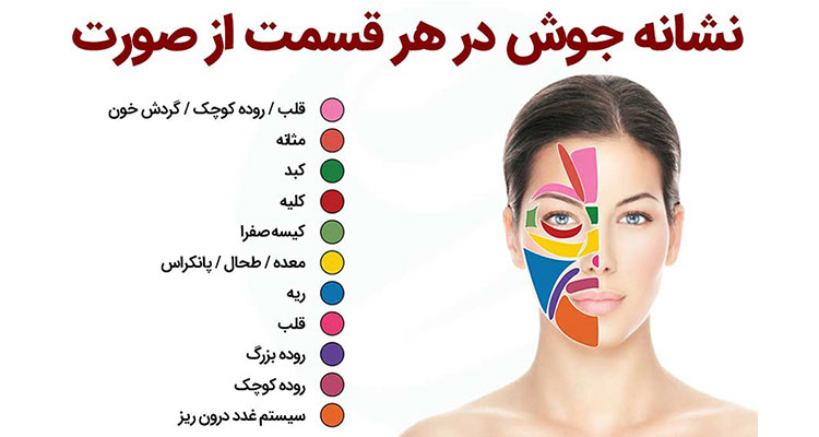 راه های خانگی درمان جوش صورت