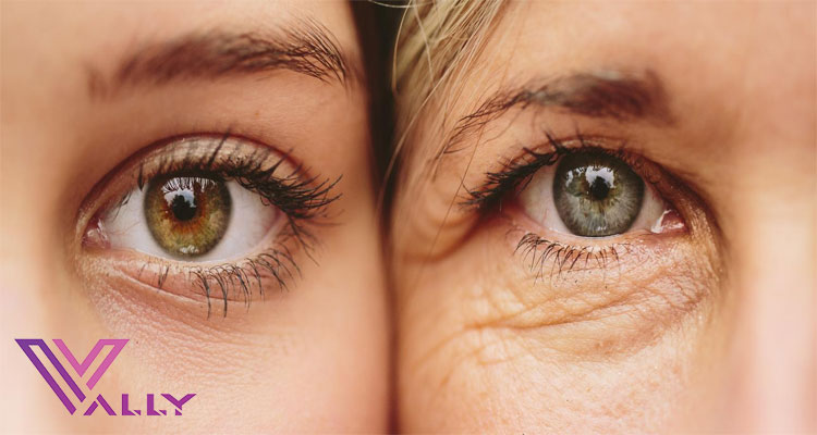پیر چشمی و راه درمان